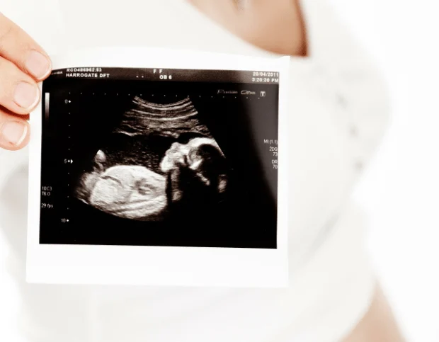 La souffrance ressentie des bébés à naître